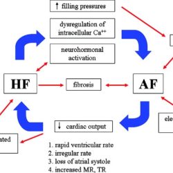 Heart failure and atrial fibrillation hesi case study